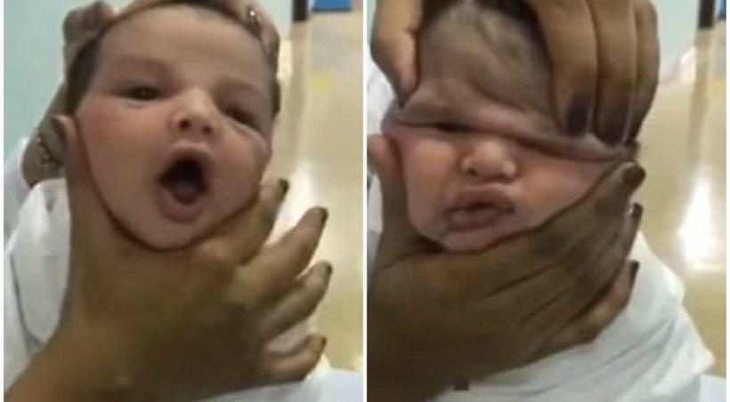 Bίντεο: Νοσηλεύτριες πίεζαν το κεφάλι νεογέννητου σε νοσοκομείο και γελούσαν