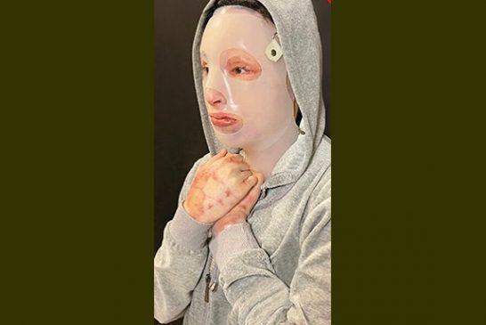 Οι συγκλονιστικές αποκαλύψεις για τη μάσκα της Ιωάννας